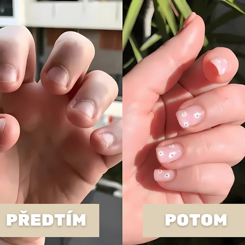 MONORA –  OTOČNÝ ANTISTRESOVÝ PRSTEN